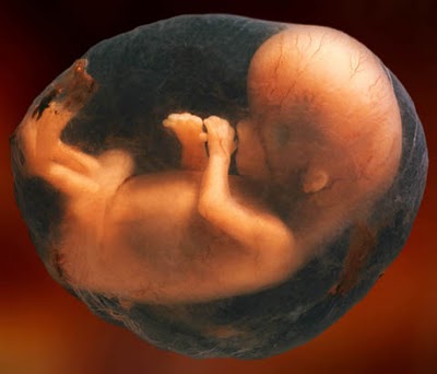 La légitimation de l’avortement détruit l’autorité du politique